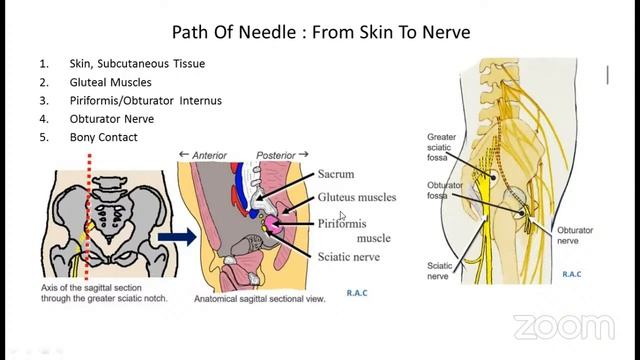 NBFM- Anatomical Basis of Nerve Blocks смотреть онлайн