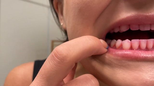 DENTIST PRODUCT REVIEW - Bitvae & Waterpik Cordless Water Flossers - which comes out on top? смотреть онлайн