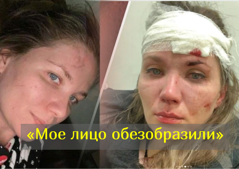 Обидчица, разбившая бокал об голову экс-жены Епифанцева актрисы Веденской, освобождена от наказания смотреть онлайн