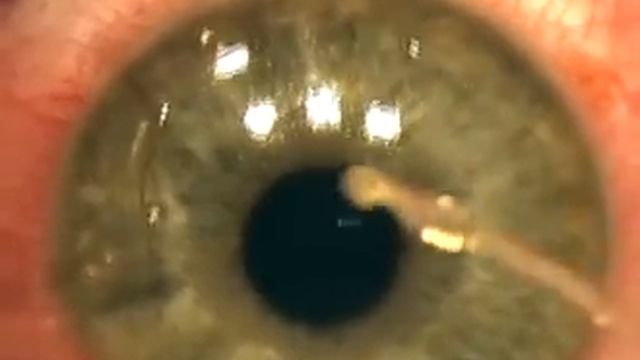 Ласик смотреть онлайн