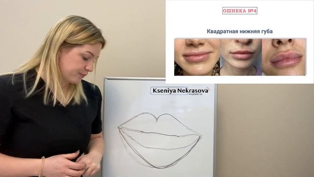 7 частых ошибок контурной пластики губ смотреть онлайн
