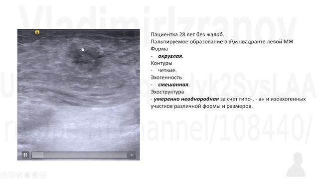 BIRADS 4b.  Клинический случай. Анализ видео примера