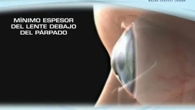 Lentes de contacto de jhonson y jhonson. Para Astigmatismo смотреть онлайн