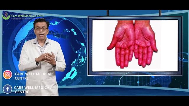Vitamin D Benefits in Autoimmune Disease Treatment (विटामिन डी के फायदे) | Care Well Medical Centre смотреть онлайн