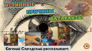 Раскрываю истинную причину возникновения катаракты! Смотрите и знайте! Развивайте зрение с нами!