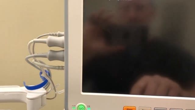 Calibrating Touch Screen Of Mindray cPM 12 смотреть онлайн