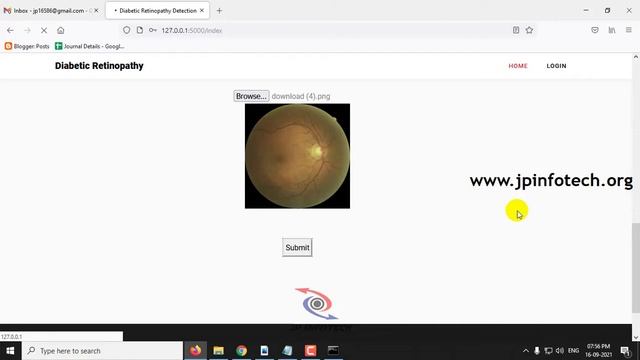 Diabetic Retinopathy Detection by means of Deep Learning | Python Final Year IEEE Project смотреть онлайн