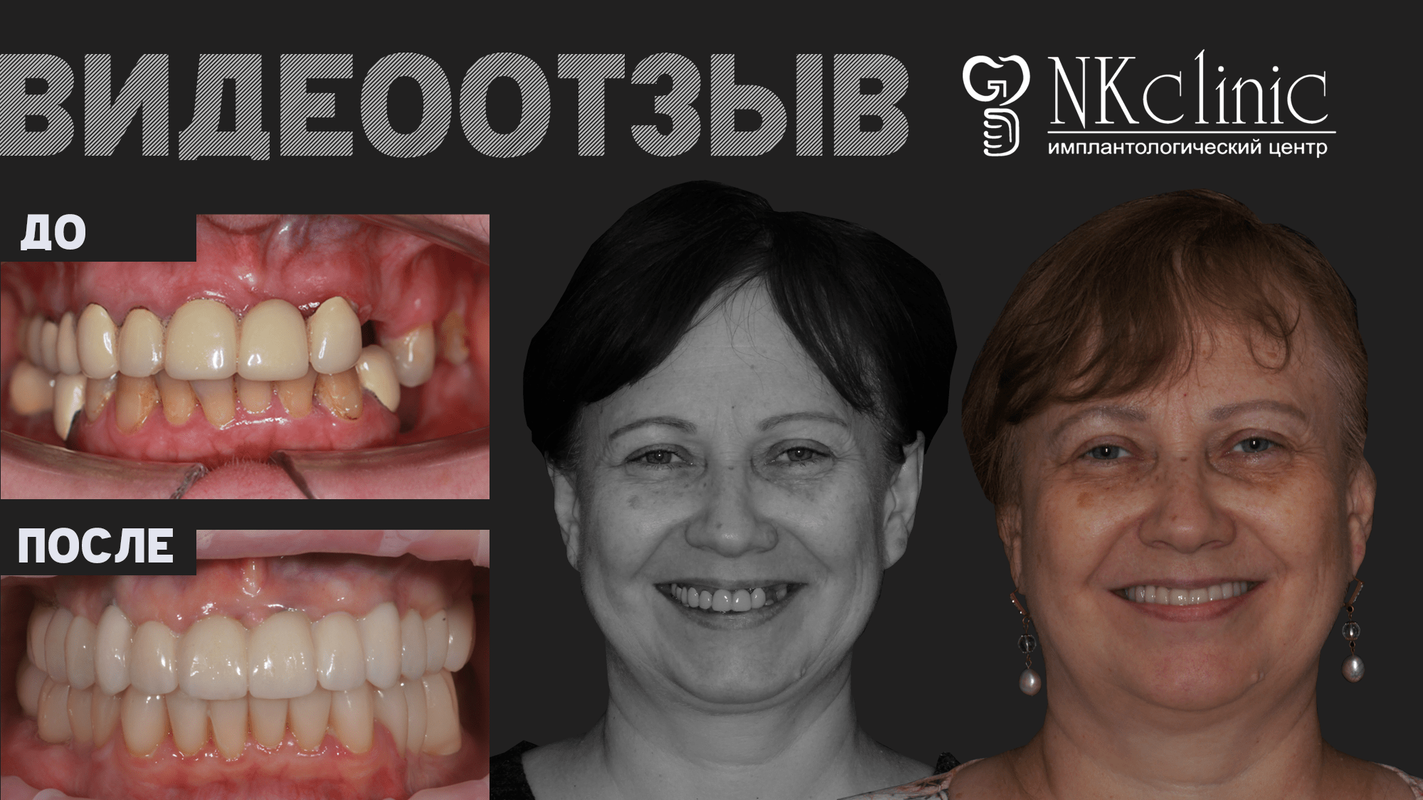 NKclinic - отзывы пациентов. Сломался зубной 