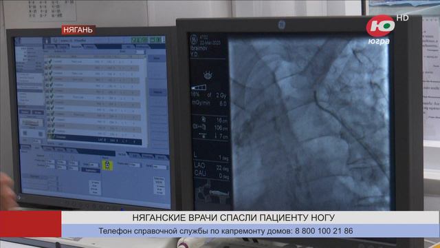 Няганские врачи спасли мужчине единственную ногу от ампутации смотреть онлайн