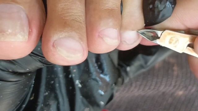 How to remove dirt, ingrown and dryskin in your toenail ? #satisfying #viral смотреть онлайн