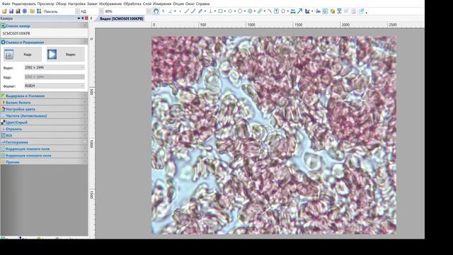 Кровь после еды, под микроскопом.