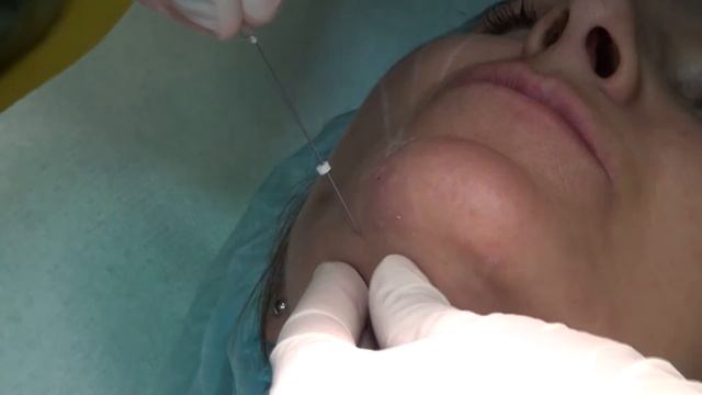 5.3 PRIME-Lifting смотреть онлайн