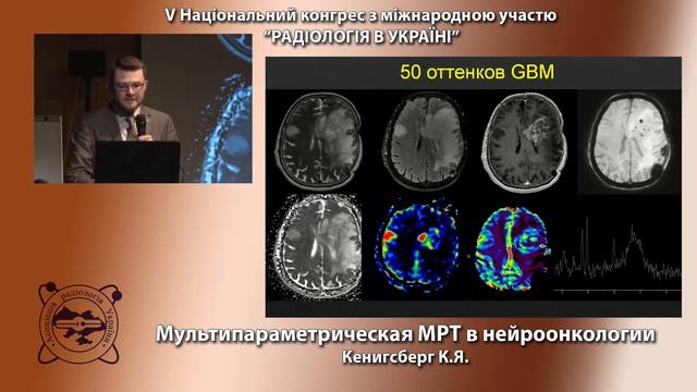 23 03 2017 MРТ в нейронокологии смотреть онлайн