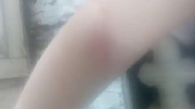 меня поцарапал котёнок смотреть онлайн