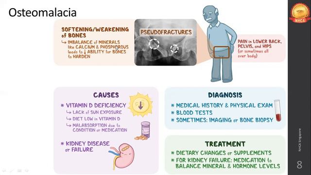Vitamin D, E & K | Nutrition Science | | Diploma in Nutrition & Dietetics Management смотреть онлайн