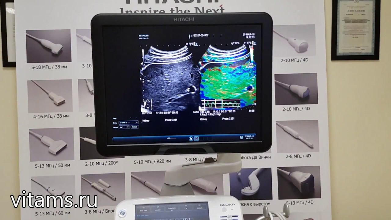 Hitachi Arietta 70 смотреть онлайн