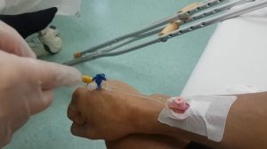 так происходит установка подкожного катетера и удаление его.