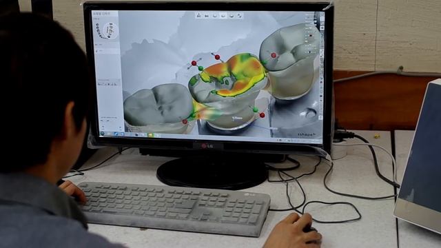exocad смотреть онлайн