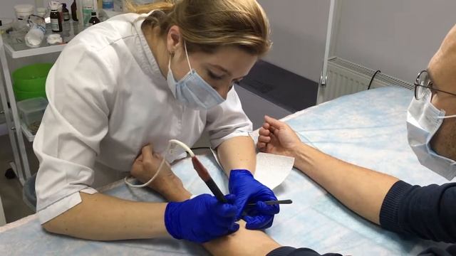 Видалення новоутворення радіохвильовим (безкровним) методом. смотреть онлайн