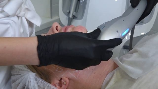 Ультраформер. Комплексный Протокол компактизации объёма лица . смотреть онлайн