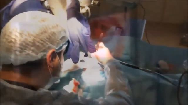 Cochlear Implantation Кохлеарная имплантация Digisonic SP Neurelec смотреть онлайн