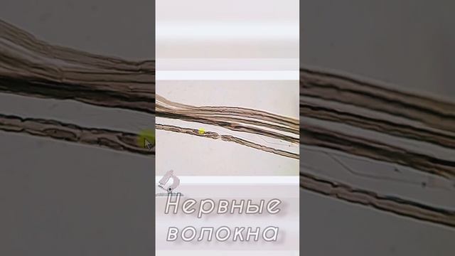 Микс из двух гистопрепаратов: безмиелиновые и миелиновые #нервные #волокна. смотреть онлайн