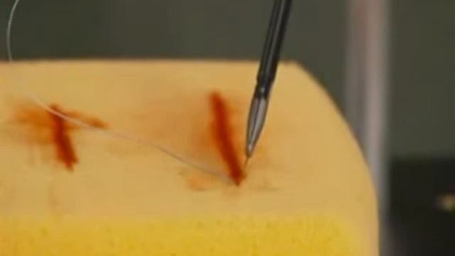 Endo Stitch сервисное видео смотреть онлайн