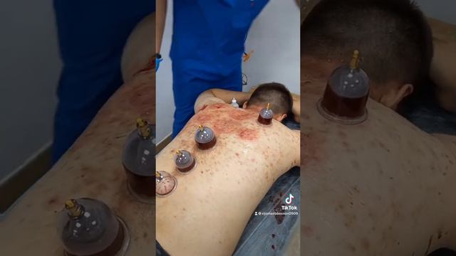 Тери таносили касаллигида Хижома Килиш Хизмати Санкт Петербург да +79217986500 смотреть онлайн