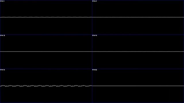 Earthworm Jim 2 (Mega Drive/Genesis) - Full Oscilloscope View смотреть онлайн