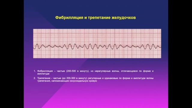 13:50 НАРУШЕНИЯ СЕРДЕЧНОГО РИТМА И ПРОВОДИМОСТИ смотреть онлайн