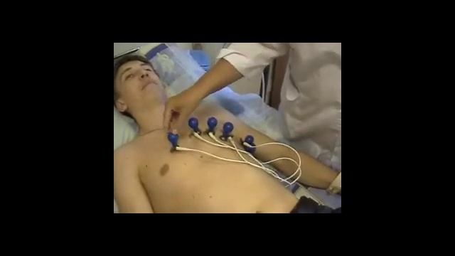 Правильное расположение электродов при ЭКГ смотреть онлайн