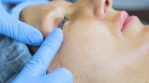 Инъекционная карбокситерапия на аппарате Venusian