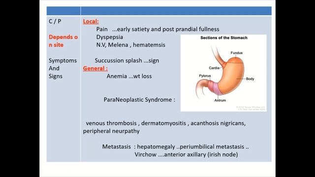 GIT Tumors(Internal Medicine) by ASM Minds Team смотреть онлайн