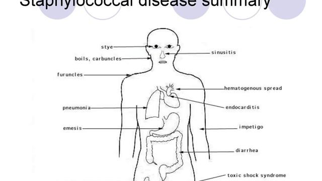 streptococcus lectures | medical laboratory technician смотреть онлайн