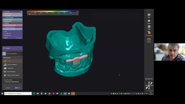 Designing A crown using Exocad Dental Software смотреть онлайн
