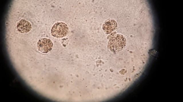 Погибают, защищая нас! Альвеолярные макрофаги - что это?. смотреть онлайн