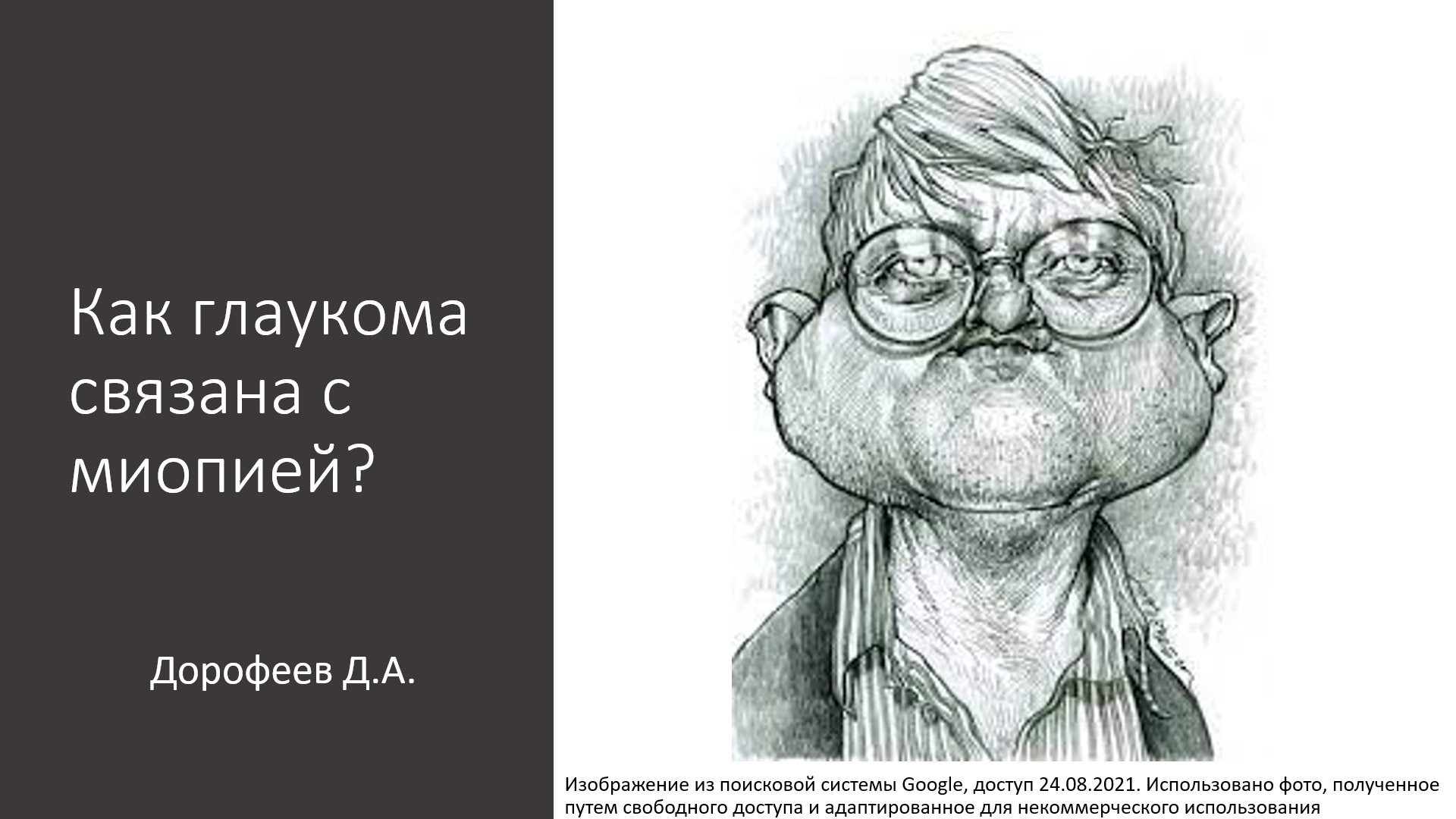 Школа глаукомы. Как глаукома связана с близорукостью (миопией)?