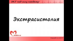 Урок 4  Видеокурс ЭКГ под силу каждому