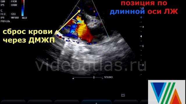 Ещё примеры ДМЖП смотреть онлайн