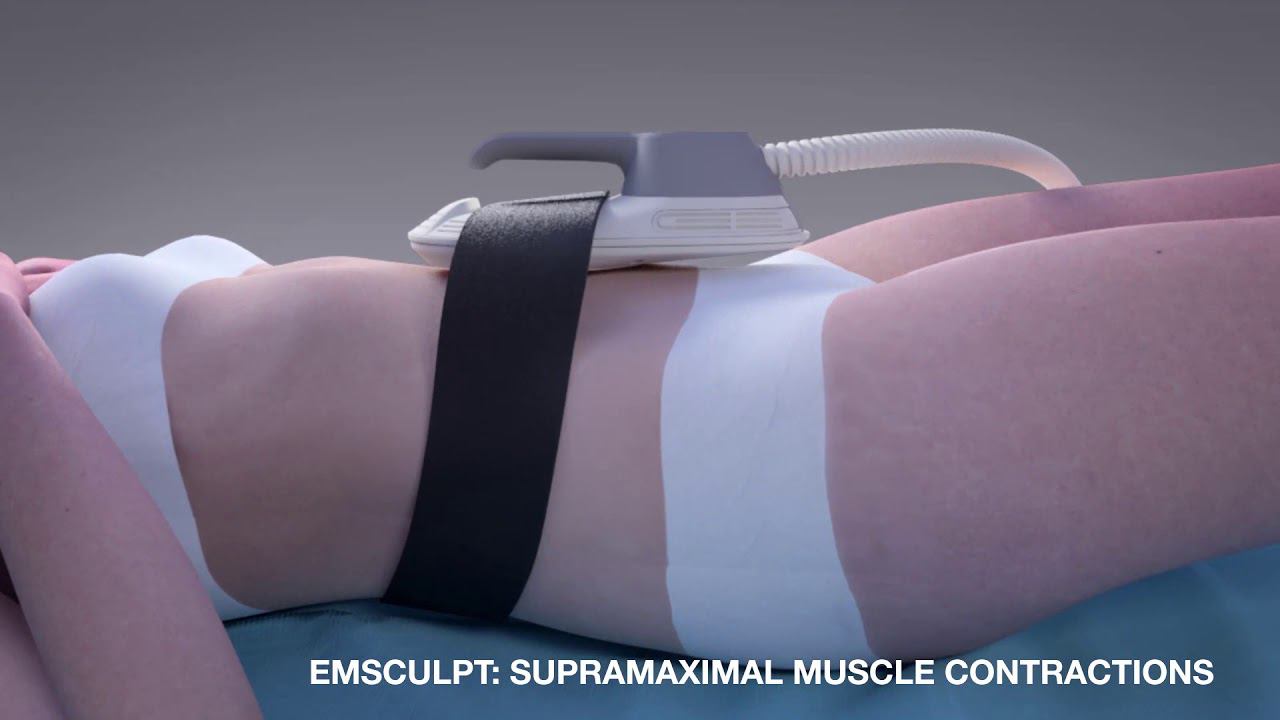 Качаем попу и живот Emsculpt смотреть онлайн
