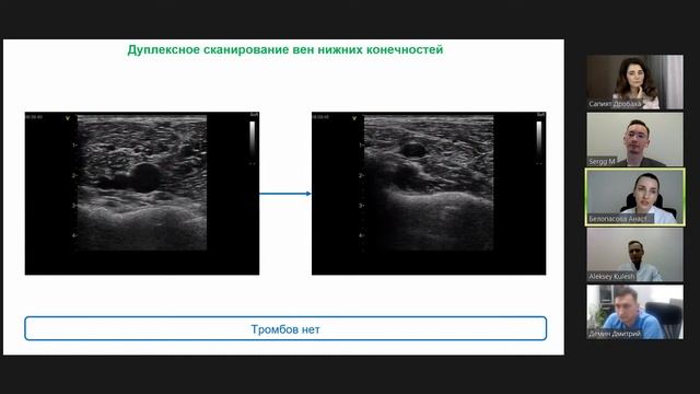 Диагностика инсульта на фоне открытого овального окна смотреть онлайн