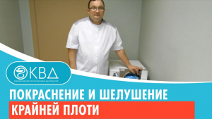 ? Покраснение и шелушение крайней плоти после антибиотиков. Клинический случай №550