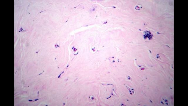 Video tool for making or designing histopathology videos | See the video link to know more смотреть онлайн