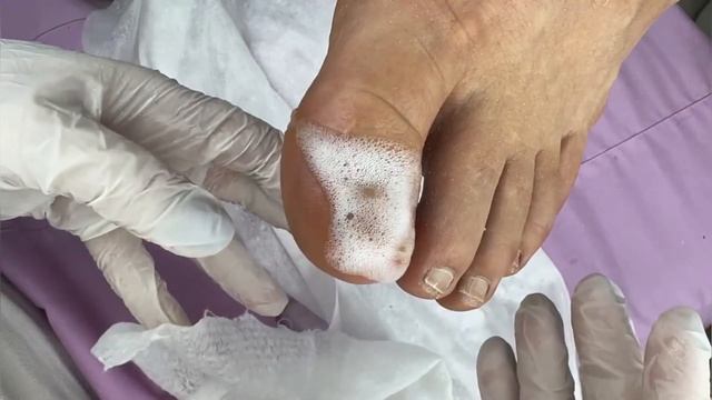 Мужской педикюр