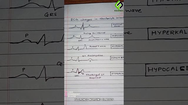 ECG CHANGES IN ELECTROLYTE DISORDERS// hypo hyperkalemia ECG // hypo hypercalcemia ECG changes смотреть онлайн
