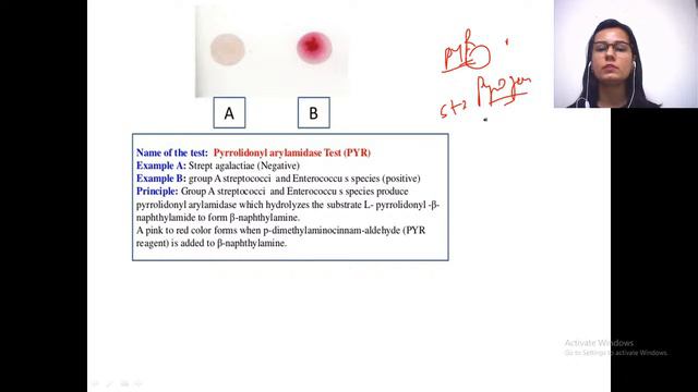 Streptococcus | NEET PG Microbiology | Target NEET PG 2021 | Dr. Muskan Chaudhary смотреть онлайн