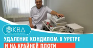 ✅ Удаление кондилом в уретре и на крайней плоти. Клинический случай №684