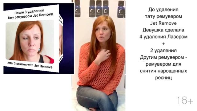 О Ремуверах для удаление татуажа и татуировок смотреть онлайн