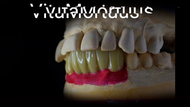 анатомия зубов стоматология карвинг зубныетехники зубы диоксид циркона (десна убежала) смотреть онлайн