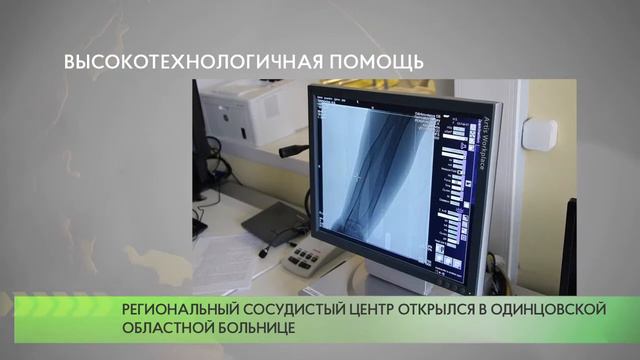 Высокотехнологичная помощь смотреть онлайн